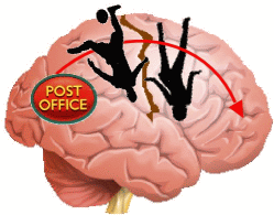brain with postoffice in the back and a footballer homunculus and a dancer homunculus