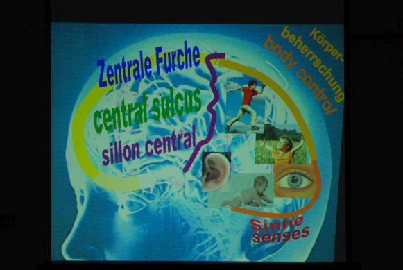 brain with pictures in the back-part